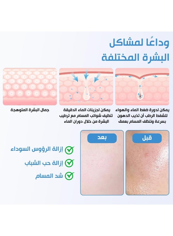 Electric Facial Oil Suction & Pore Cleaner Device, Blackhead Remover with Mini Water Bubble System, USB Rechargeable Deep Pore Cleaning Tool with Multiple Modes and Suction Heads - Image 3